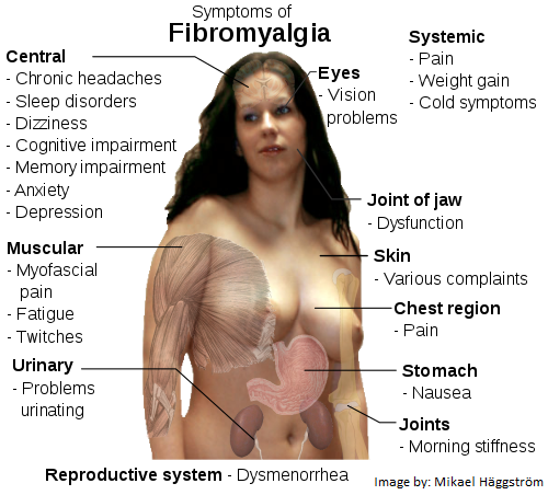 Fibromyalgia 101 for Massage Therapists, Spa & Salon Workers