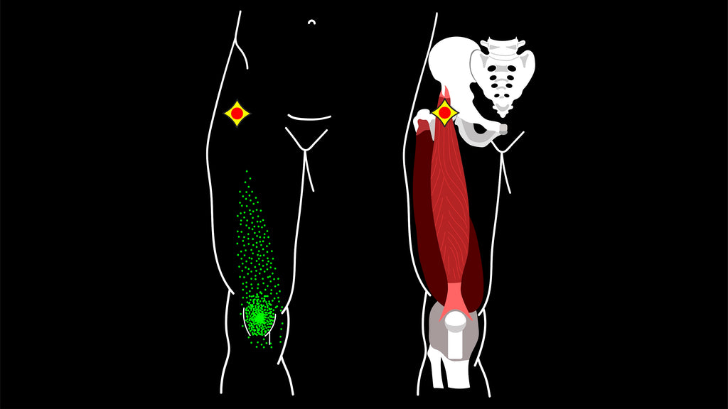 CE Institute LLC: Trigger Point Therapy Definition & How Manual TP Therapy Treatment is Administered