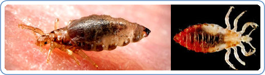 Lice & Parasitic Infections - Massage & Bodyworker Service Contraindication