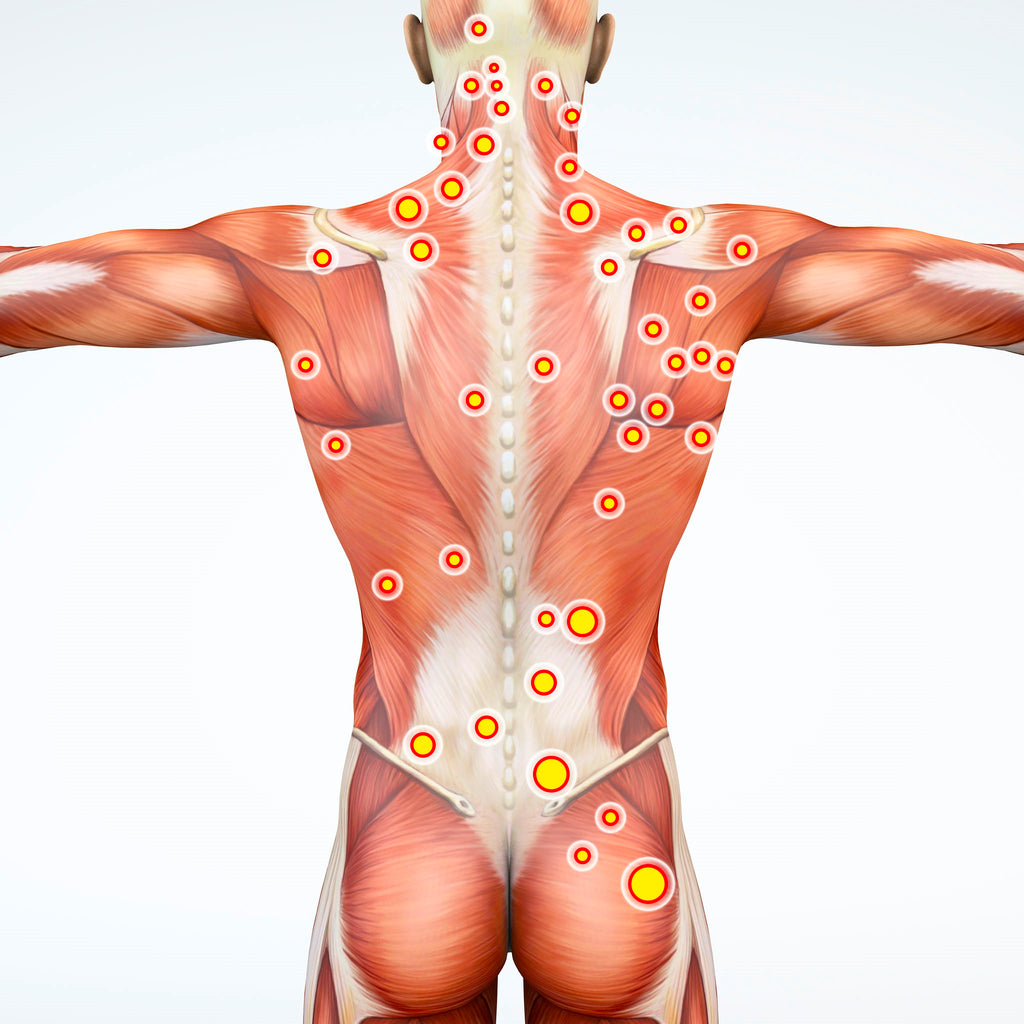Trigger Point Therapy is HERE TO STAY!