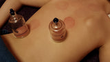 Self-paced Online Home Study 1 CE Intro to Cupping Theory