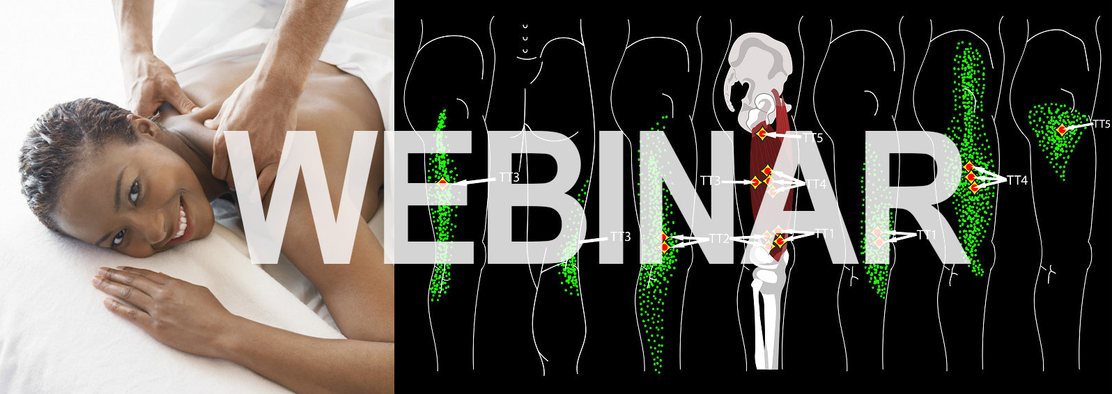 6 CE Hour Trigger Point Therapy (Computer-Based Live Interactive Webinar)