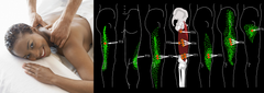 Self-paced Online Home Study 6 CE Trigger Point Therapy