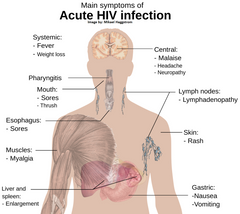 6 CE Hour HIV & AIDS Education & Bodywork