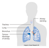 24 CE Advanced Geriatric Oncology Bodywork & Massage (Computer-Based Live Interactive Webinar)