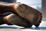 6 CE Ayurveda Foot, Face & Head Marma Massage (Computer-Based Live Interactive Webinar)