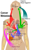 24 CE Advanced Oncology Bodywork with Manual Lymphatic Drainage (Computer-Based Live Interactive Webinar)