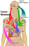 24 CE FL LMT Renewal Home Study Package: Swedish Oncology & Bodywork for Cancer