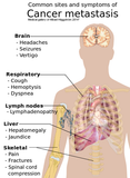 24 CE Advanced Oncology Bodywork with Manual Lymphatic Drainage (Computer-Based Live Interactive Webinar)