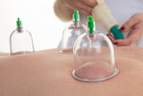 18 CE Hour Advanced Myofascial Cupping (Computer-Based Live Interactive Webinar)