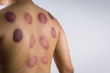 18 CE Hour Advanced Myofascial Cupping (Computer-Based Live Interactive Webinar)