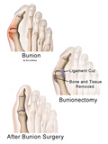 Self-paced Online Home Study 12 CE Active Assisted LOWER Body Stretching (AAS) & Advanced Medical Foot Massage