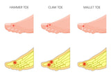 Self-paced Online Home Study 12 CE Foot Reflexology Basics with Advanced Medical Foot Massage