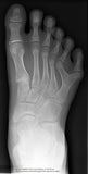 Self-paced Online Home Study 12 CE Active Assisted LOWER Body Stretching (AAS) & Advanced Medical Foot Massage