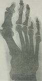 Self-paced Online Home Study 12 CE Foot Reflexology Basics with Advanced Medical Foot Massage