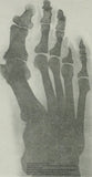 LIVE-IN PERSON 12 CE Hour Foot Reflexology Basics with Advanced Medical Foot Massage in CENTRAL FLORIDA