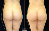 LIVE IN-PERSON 24 CE Hour Manual Lymphatic Drainage Full Body & Facial in Miami FL