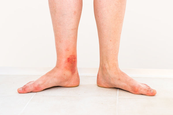 Self-paced Online Home Study 12 CE Manual Lymphatic Drainage