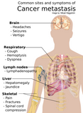 24 CE Advanced Geriatric Oncology Bodywork & Massage (Computer-Based Live Interactive Webinar)