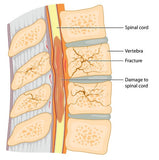Self-paced Online Homestudy 24 CE Advanced Medical Massage