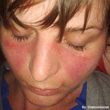 12 CE Hour Lymphatic Drainage Basics & Lymphatic Facial