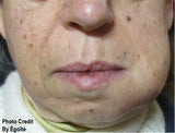 6 CE Hour Lymphatic Facial (Computer-Based Live Interactive Webinar)