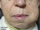 LIVE-IN PERSON 6 CE Hour Lymphatic Facial in Miami Florida