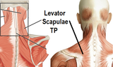 Self-paced Online Home Study 12 CE Trigger Point & Neuromuscular Therapy Basics