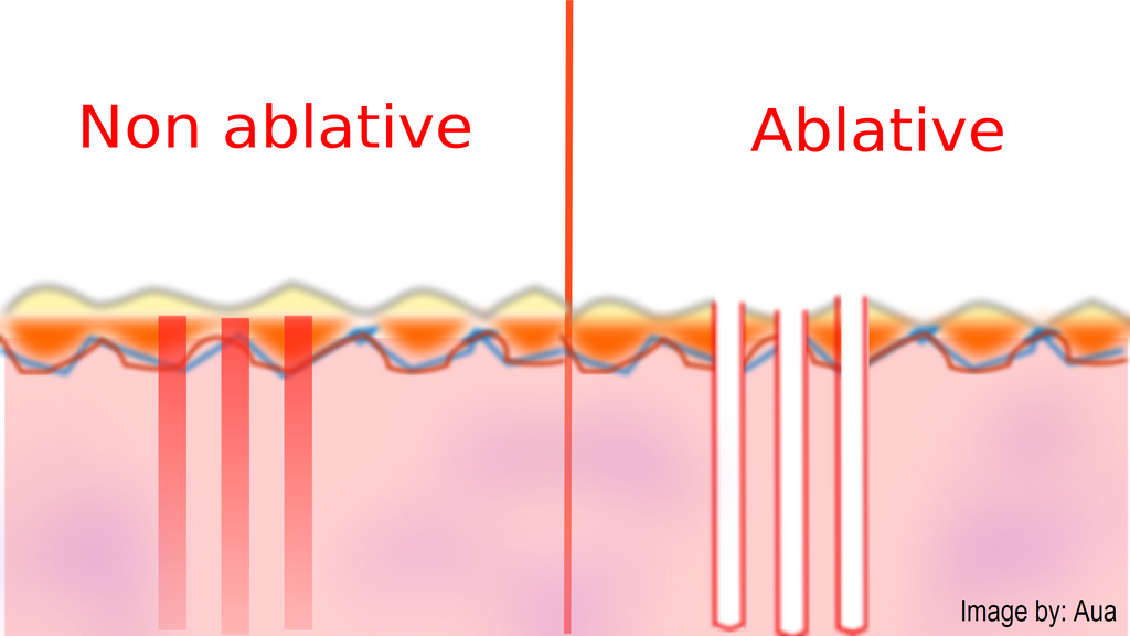 Ablative Cosmetic Laser Treatment with Manual Lymphatic Drainage (MLD) and other Bodywork Services