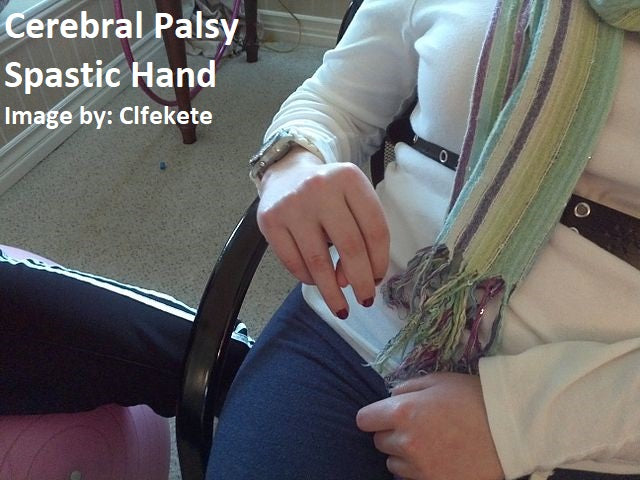 Cerebral palsy (CP) - Massage Therapy, Spa & Salon Service Precaution