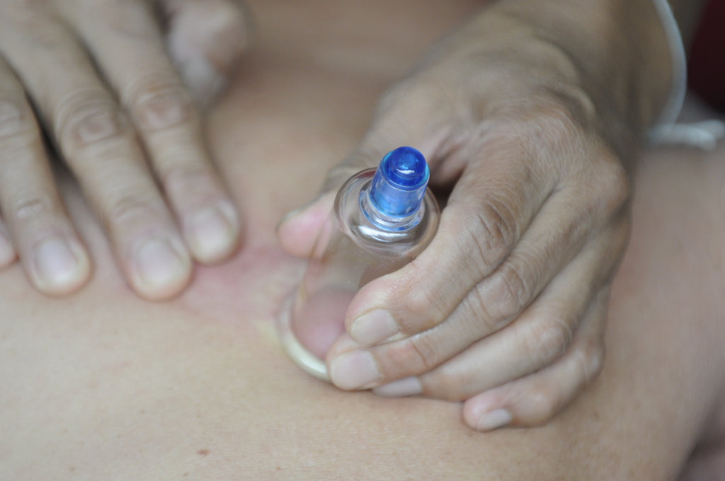 The Modality, Definition & 10 Points of Orthopedic Cupping