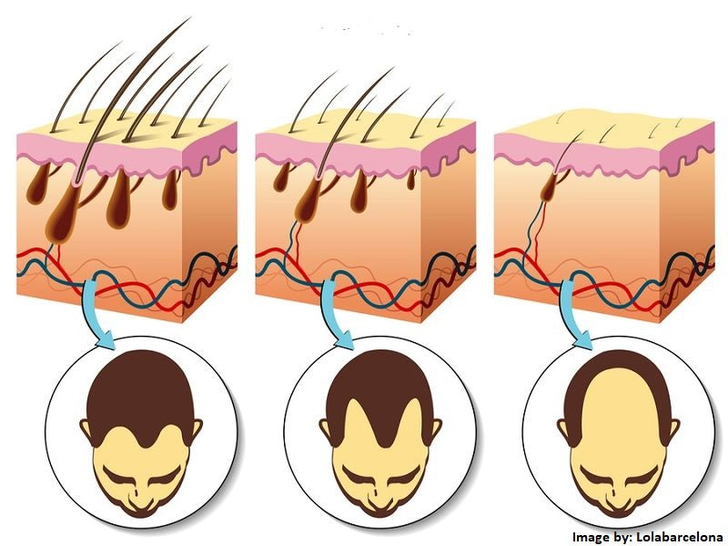 Hair Loss 101 - for Massage Therapists, Spa & Salon Workers