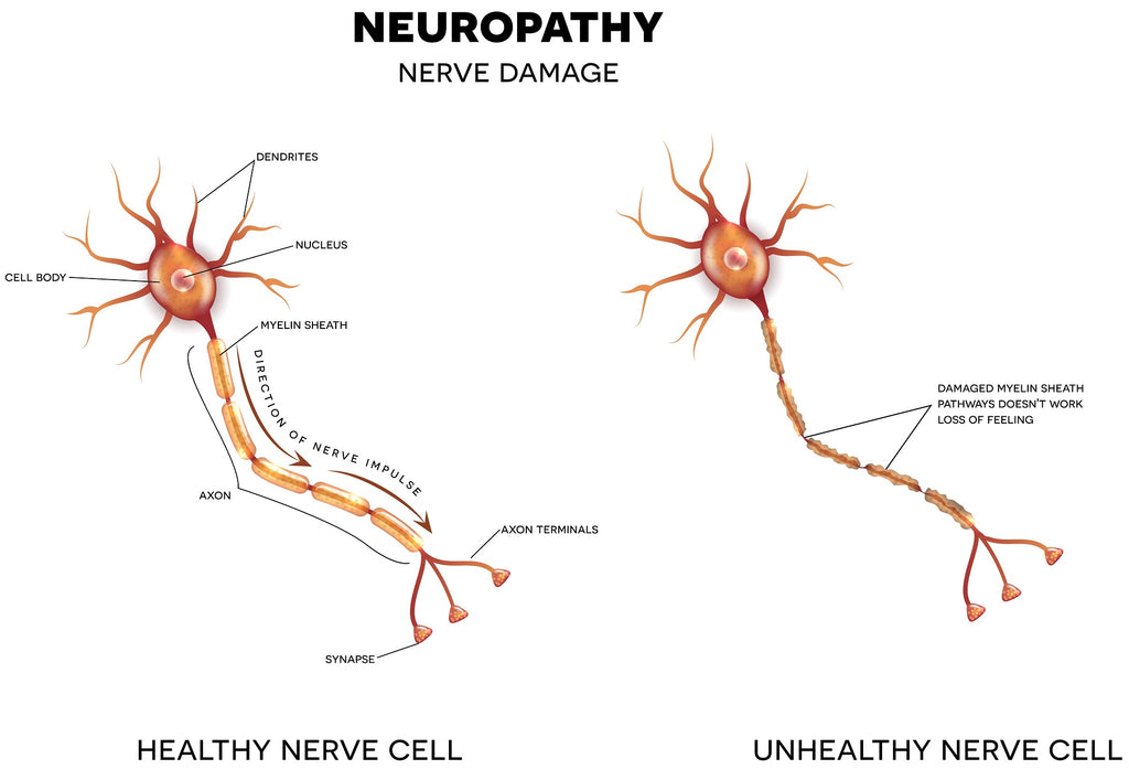 Diabetic Neuropathy & Peripheral Neuropathy Local Service Contraindication