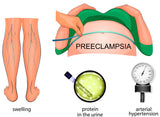 Self-paced Online Home Study 3 CE Bodywork for Cardiovascular Compromised Clients