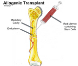 Self-paced Online Home Study 1 CE Hour Oncology Bodywork: Cancer Treatments