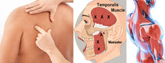 Self-paced Online Home Study 12 CE Trigger Point & Neuromuscular Therapy Basics