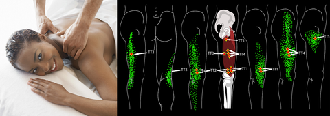 Self-paced Online Home Study 6 CE Trigger Point Therapy