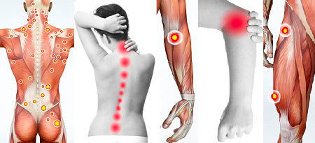 LIVE IN-PERSON 6 CE Hour Trigger Point Therapy