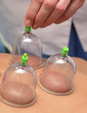 LIVE IN-PERSON 12 CE Hour Orthopedic Cupping