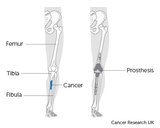 LIVE IN-PERSON 12 CE Swedish Oncology & Bodywork for Cancer