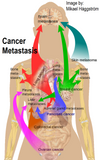LIVE IN-PERSON 24 CE Advanced Oncology Bodywork with Manual Lymphatic Drainage