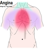 LIVE IN-PERSON 12 CE Hour Advanced Geriatric and Seniors Massage and Bodywork