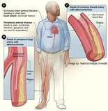 Self-paced Online Home Study 3 CE Hour Bodywork for Cardiovascular Compromised Clients