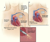 Self-paced Online Home Study 3 CE Bodywork for Cardiovascular Compromised Clients