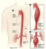 Self-paced Online Home Study 3 CE Hour Bodywork for Cardiovascular Compromised Clients