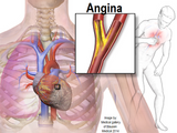 LIVE IN-PERSON 12 CE Hour Advanced Geriatric and Seniors Massage and Bodywork
