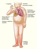 Self-paced Online Home Study 3 CE Bodywork for Cardiovascular Compromised Clients
