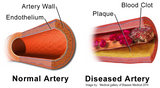 Self-paced Online Home Study 3 CE Bodywork for Cardiovascular Compromised Clients