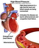 Self-paced Online Home Study 3 CE Bodywork for Cardiovascular Compromised Clients
