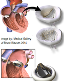 Self-paced Online Home Study 3 CE Bodywork for Cardiovascular Compromised Clients